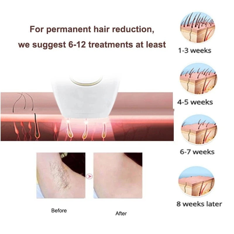 Mardini Glow™ IPL Laser Hair Removal Device